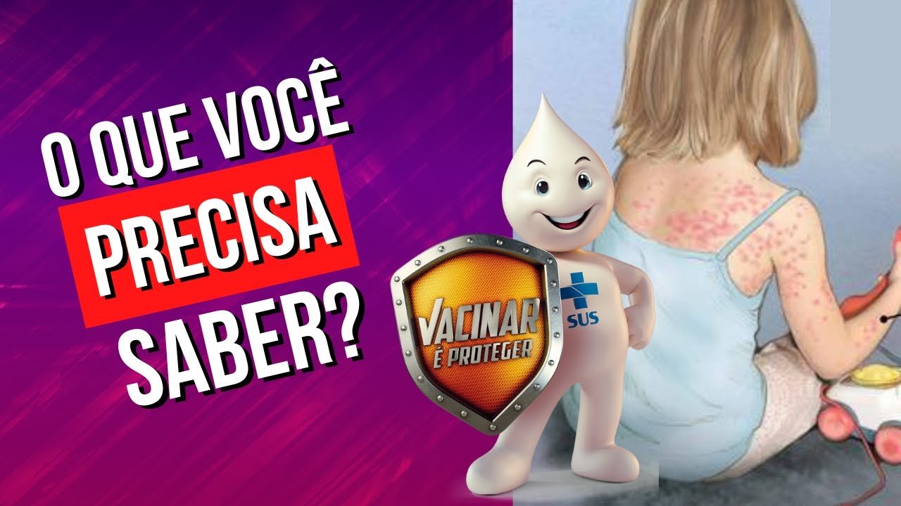Descubra Por Que o Sarampo é Contagioso: Proteja Sua Família Agora!