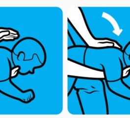 American Heart Association altera protocolo de desengasgo e prioriza pancadas nas costas