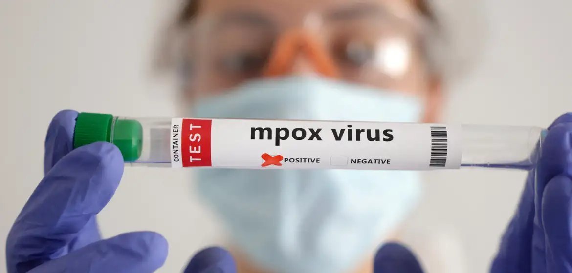 Saúde de São Paulo confirma segundo caso de mpox do grupo lp no estado - Imagem do artigo original