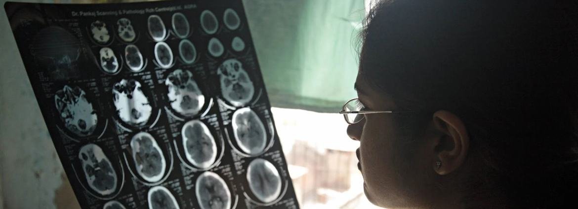 Quase 470 milhões nas Américas convivem com algum distúrbio neurológico, indica estudo - Imagem do artigo original